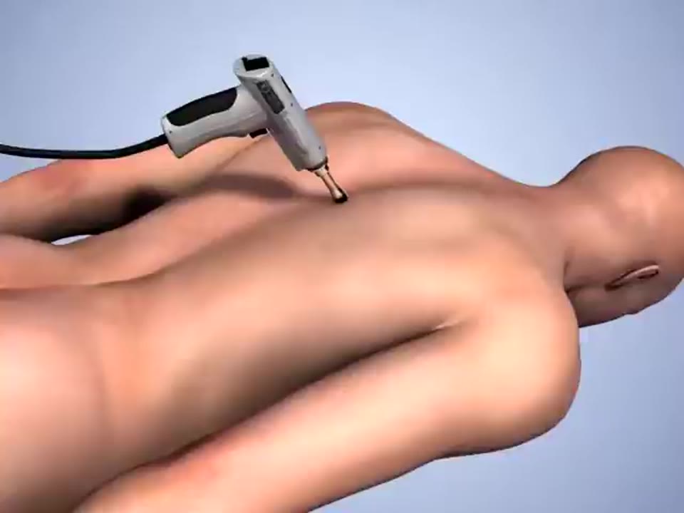 Impulse iQ — 3D Animation Promo video still